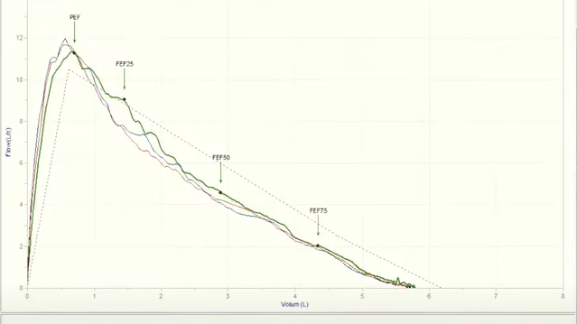 Jämför spirometri, visa trend, med mera