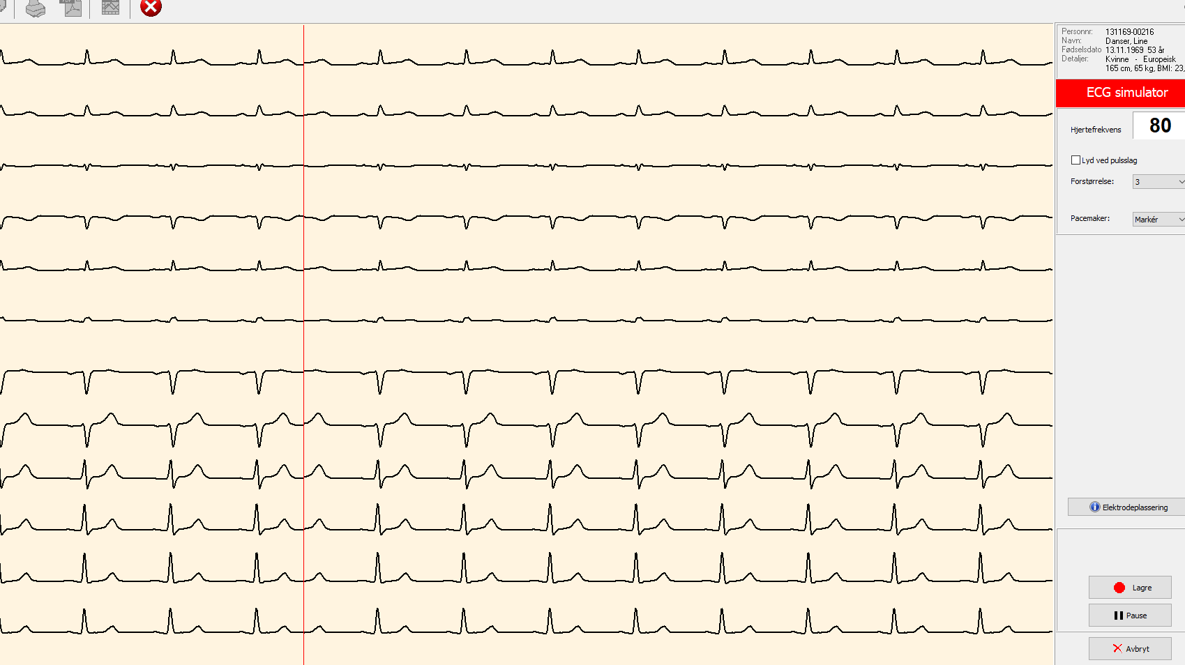 Tutorial Spirare software EKG